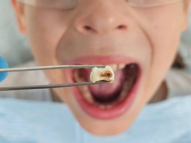 Best Emergency Treatment for Toothache in Deltana, AK
